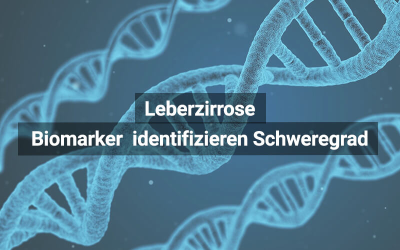 Gefährliche Leberzirrhose mit Biomarker erkennen