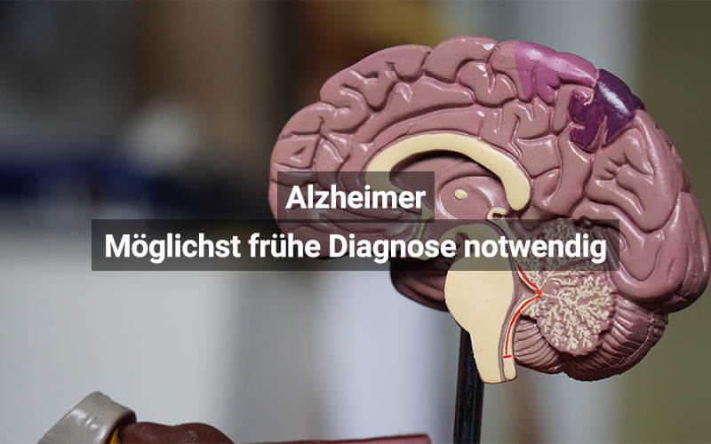 Alzheimer: Möglichst frühe Diagnose notwendig