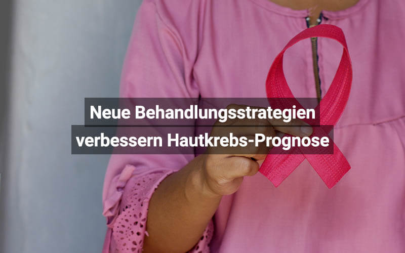 Neue Behandlungsstrategien verbessern Hautkrebs-Prognose