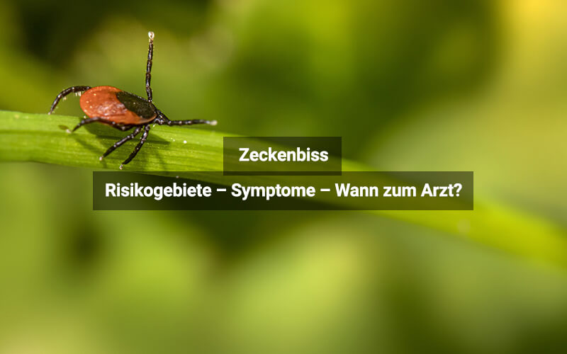 Zeckenbiss: Symptome und wann zum Arzt?