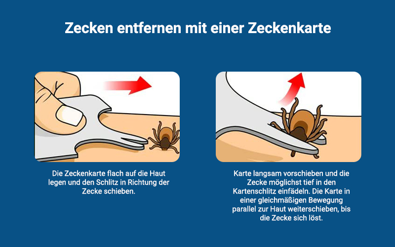 Zeckenbiss Zecken Entfernen Zeckenkarte