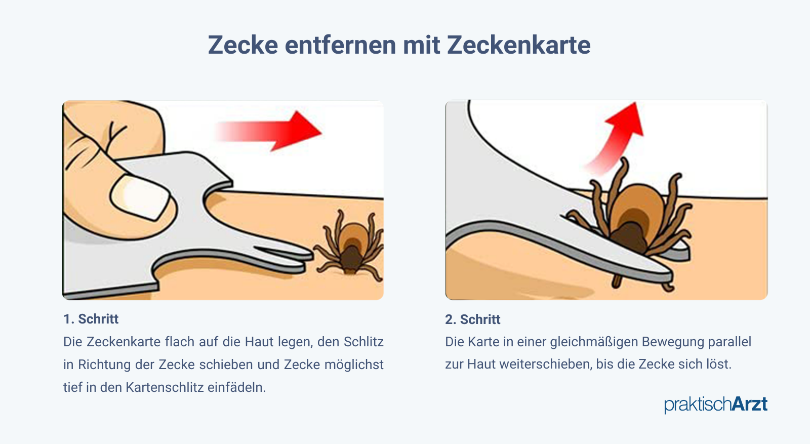 Zecke Entfernen Mit Zeckenkarte