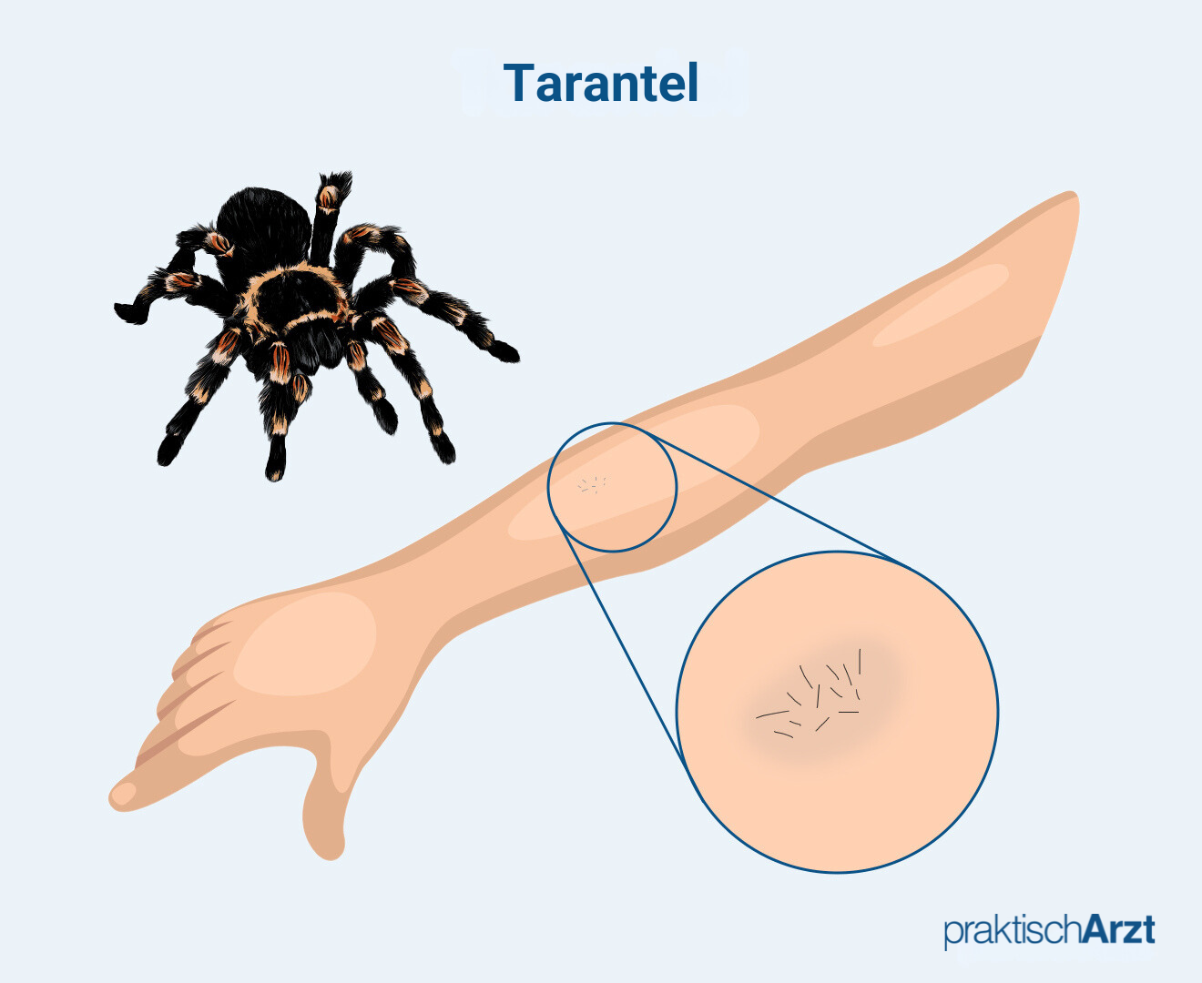 Biss Tarantel