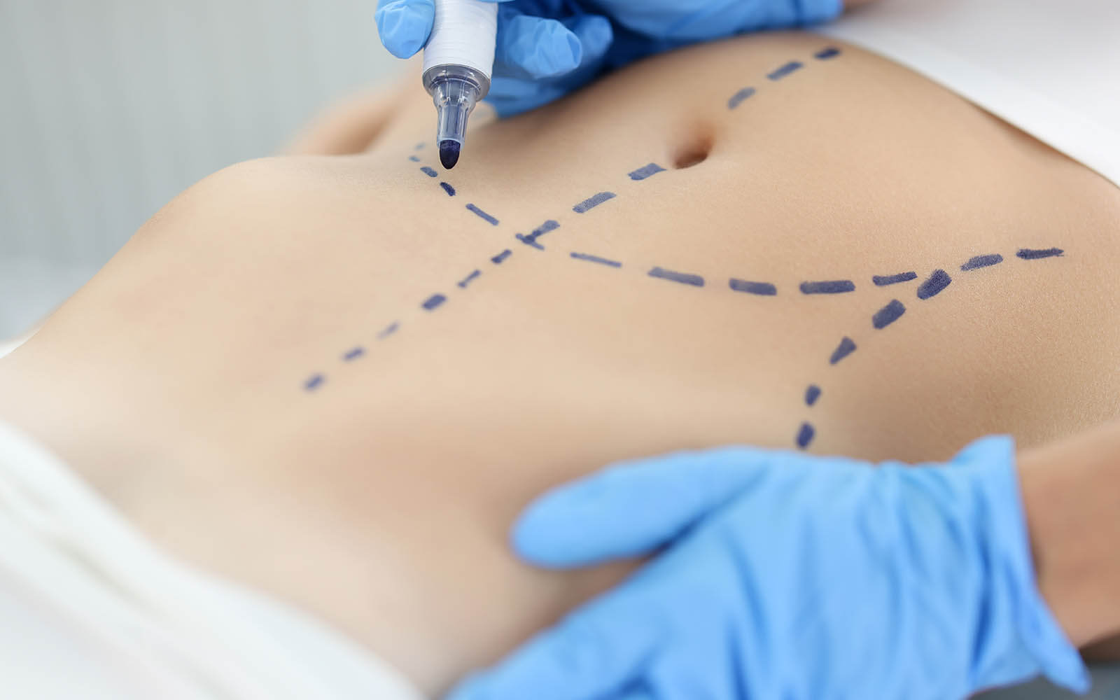 Facharztausbildung Für Plastische Und Ästhetische Chirurgie