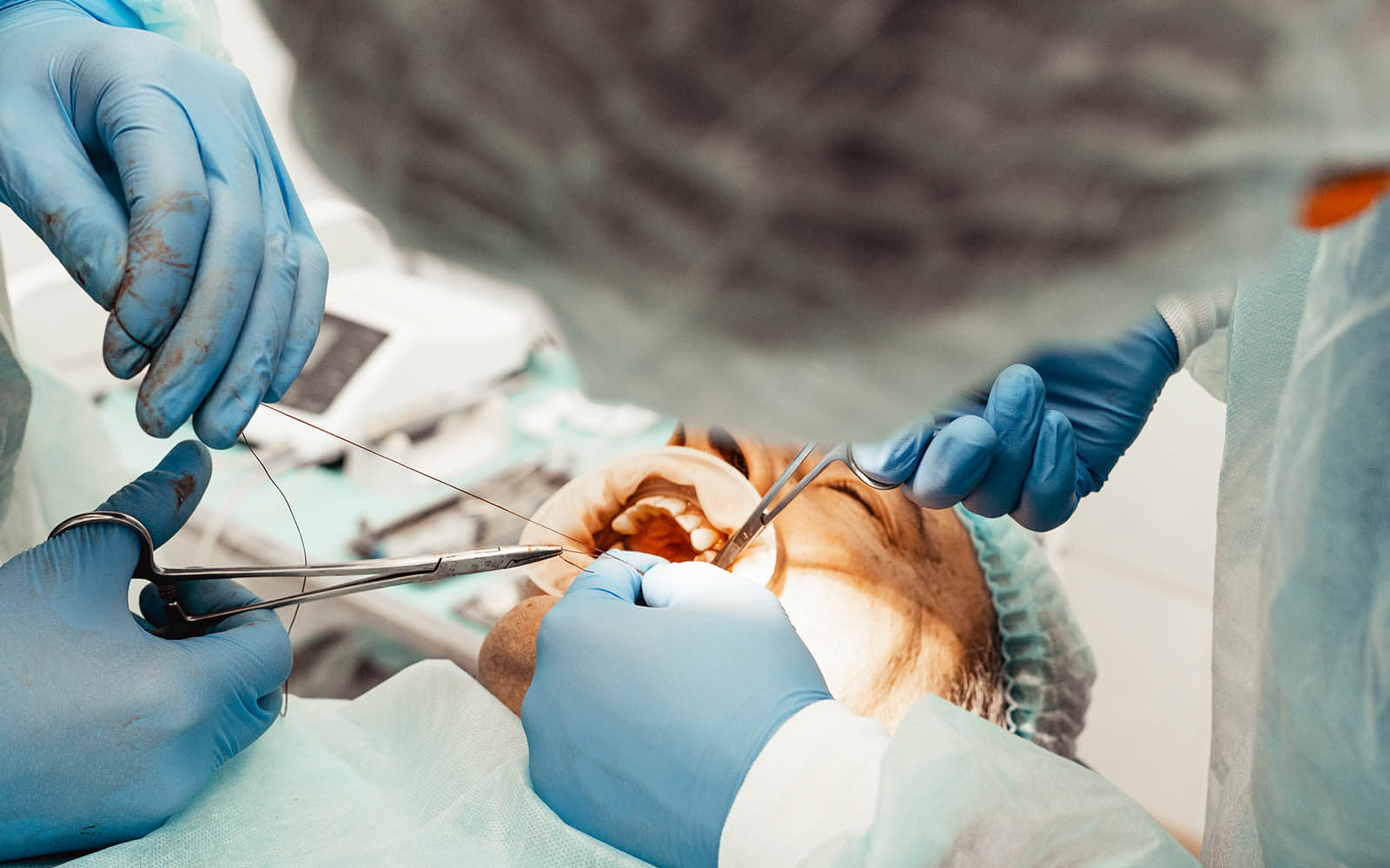 Weiterbildung Facharzt Mkg Chirurgie